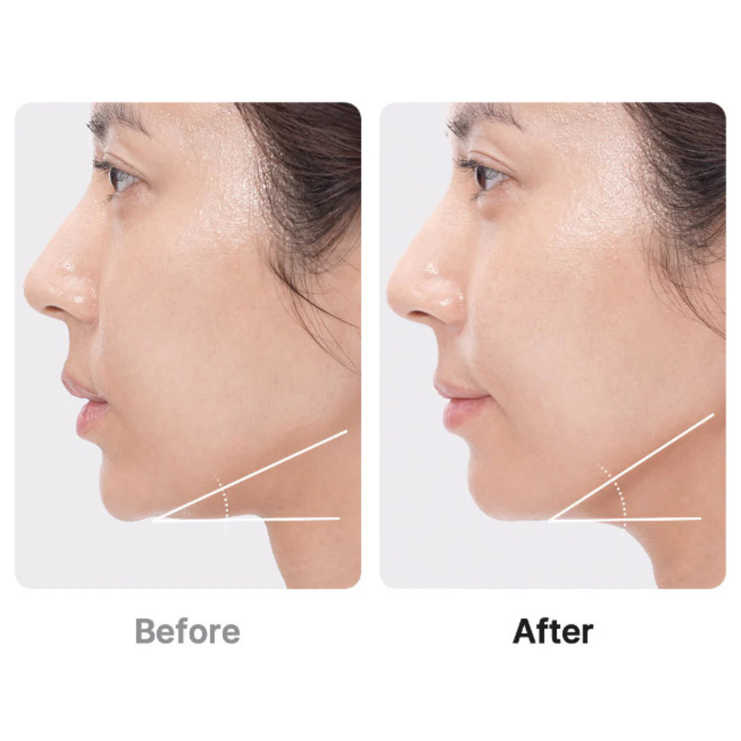 Medicube AGE-R BOOSTER PRO | 6-in-1 Glass Skin Total Care Device - Pre-order