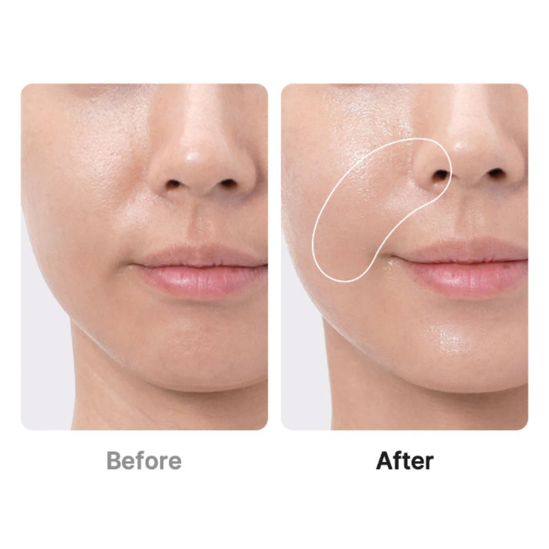 Medicube AGE-R BOOSTER PRO | 6-in-1 Glass Skin Total Care Device - Pre-order