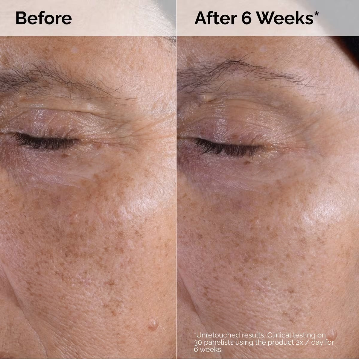 The Ordinary Toner for Bright, Smooth Skin
