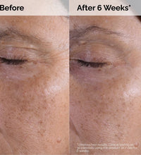 The Ordinary Toner for Bright, Smooth Skin
