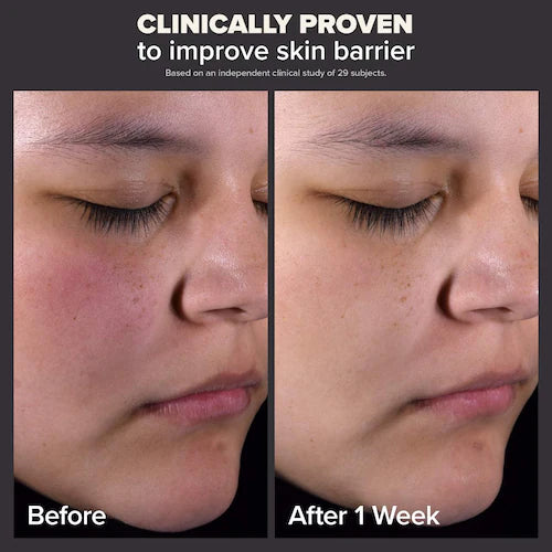 Paula's Choice Skin Perfecting 2% BHA Liquid Exfoliant for Clear Skin - 30ml