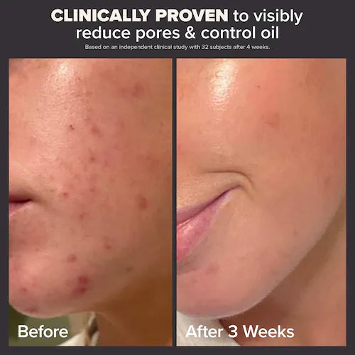 Paula's Choice Skin Perfecting 2% BHA Liquid Exfoliant for Clear Skin - 30ml