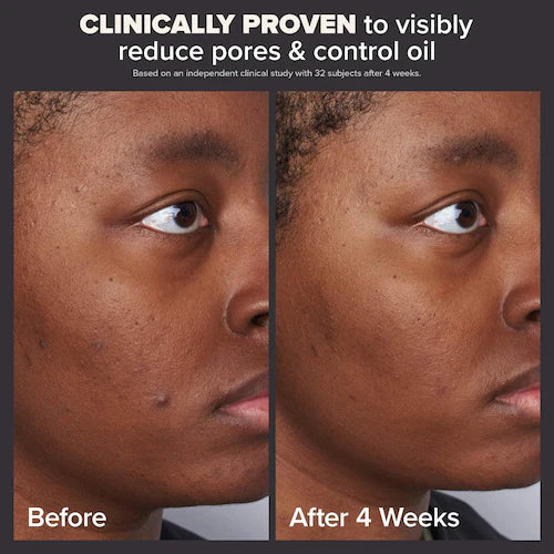 Paula's Choice Skin Perfecting 2% BHA Liquid Exfoliant for Clear Skin - 30ml