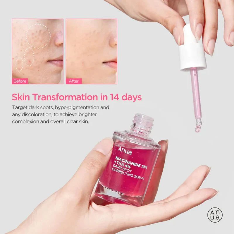 ANUA Niacinamide 10% + TXA 4% Dark Spot Correcting Serum 30ml